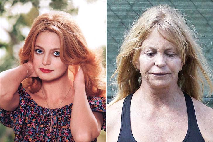 15-beautiful-stars-who-have-aged-horribly_10
