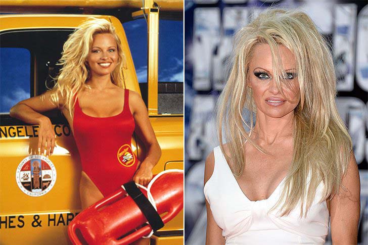 15-beautiful-stars-who-have-aged-horribly_3