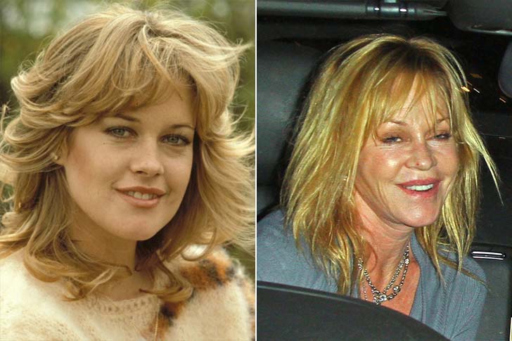 15-beautiful-stars-who-have-aged-horribly_8