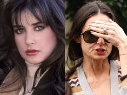 17 Beautiful Stars Who Are Aging So Fast