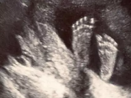 Mom Thinks She's Having A Baby Until She Sees The Ultrasound Pic